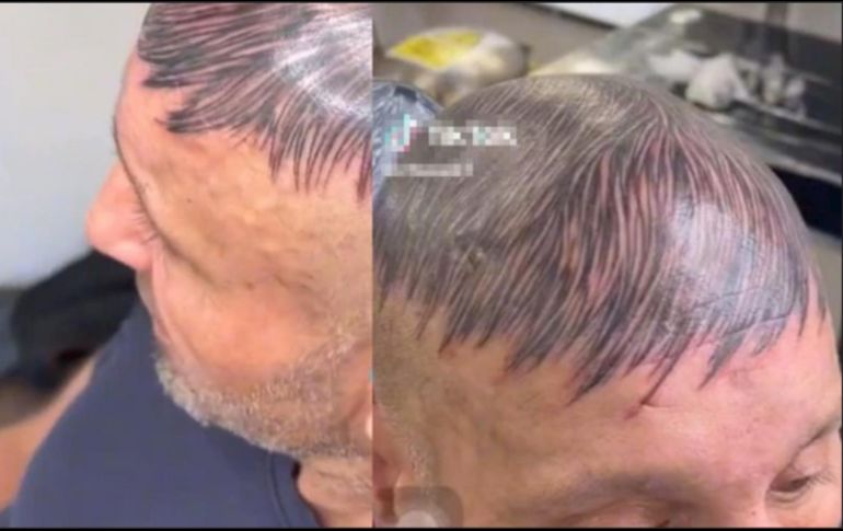 En lugar de hacerse un 