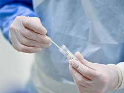 La OMS ha señalado a China que deben hacerse más estudios que sigan la pista del animal que puede haber actuado como intermediario y contagiado a los humanos. AFP / ARCHIVO