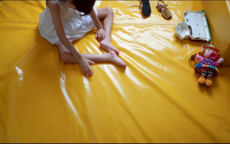 Señalan que sólo el 50 de los pacientes fármaco resistentes suelen ser candidatos para una cirugía epiléptica. AFP/ARCHIVO