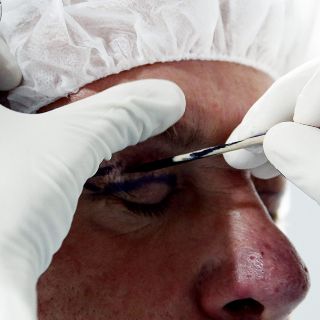 Olvidan reforma para endurecer sanciones a pseudo cirujanos 