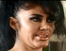 Miriam Yukie Gaona Padilla fue detenida en junio del año 2002 luego de decenas de denuncias de mujeres la acusaron de responsable de procedimientos estéticos en contra de ellas. ESPECIAL