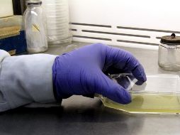 La meningitis es considerada una de las enfermedades más peligrosas en la infancia. NTX / ARCHIVO