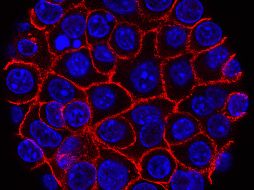 La modificación en esta proteína puede aumentar mucho la malignidad, dijeron los autores. Imagen de archivo. ESPECIAL/Unsplash