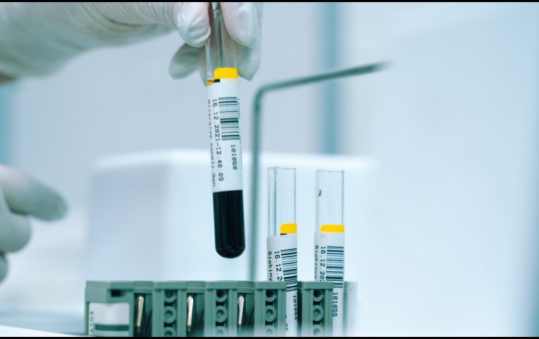 A pesar de que el panorama de esta enfermedad ha mejorado, el virus sigue transmitiéndose en ciertos grupos y países, particularmente en la región del Pacífico Occidental. ESPECIAL/Foto de Akram Huseyn en Unsplash