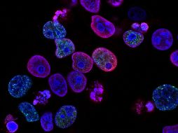 La presencia y forma de expresión de la HAPLN1 podría usarse para identificar a quienes necesitan un seguimiento más exhaustivo o incluso tratamientos diferenciados, según los expertos. ESPECIAL/Unsplash