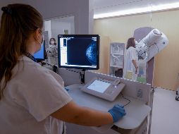 Los estudios mamográficos son clave en la detección de los cánceres mamarios. EFE/Archivo