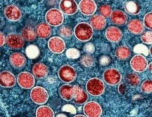 Los programas de investigación y desarrollo de la OMS se esfuerzan por preparar al mundo ante lo desconocido. AP