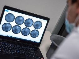 Podría ayudar a convertir el cáncer en una enfermedad crónica y potenciar la eficacia de los fármacos para combatirlo, aseguran los científicos. EFE/Archivo.