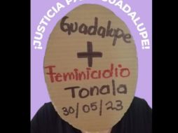 La mujer presentaba quemaduras de segundo y tercer grados. SUN