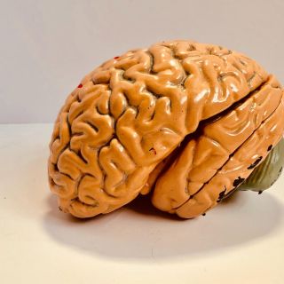¿Se puede trasplantar el cerebro?