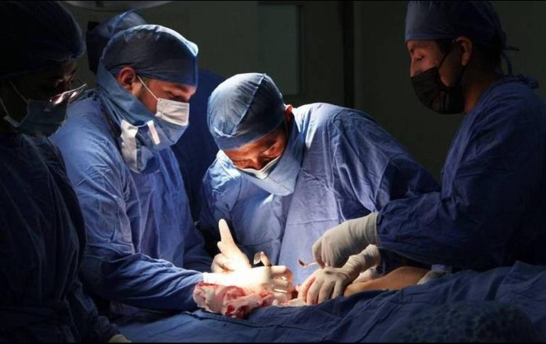 La entidad con menos trasplantes es Nayarit. ESPECIAL