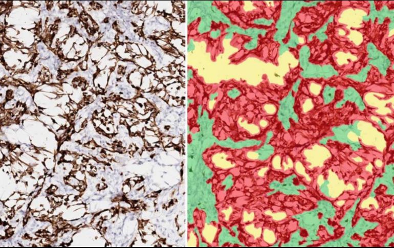 Dos imágenes de tumores de ratón. Los segmentos rojos de la derecha son células cancerosas. EFE/ Imagen cedida por Laboratorio Janowitz/Laboratorio Cold Spring Harbor