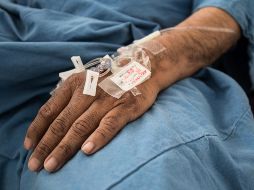 La parálisis flácida aguda puede ser causada por diversas enfermedades de tipo infecciosas, hematológicas, oncológicas, intoxicaciones, malformaciones genéticas, lesiones físicas y enfermedades autoinmunes. NTX / ARCHIVO