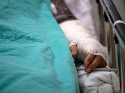 En México, entre 1989 y 2017, la lepra disminuyó 97%, concentrándose el mayor número en los estados de Guerrero, Jalisco, Oaxaca, Sinaloa, así como Michoacán. AFP / ARCHIVO