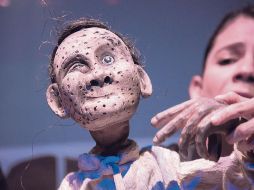 “Trino” lleva las cicatrices que le dejó la viruela. CORTESÍA