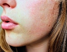 Hasta el momento no existe nada que pueda prevenir padecimientos que tengan un gran carga genética. ESPECIAL/PEXELS