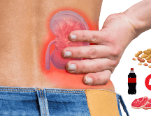 Limitar la ingesta de estos alimentos puede ayudar a mantener la salud renal. ESPECIAL / Prexels vía blueshot