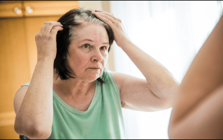 Fumar acelera la aparición de canas, especialmente en fumadores menores de 40 años. ESPECIAL / Prexels vía JRP Studio