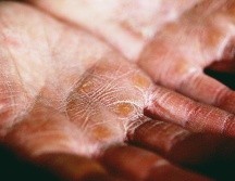 Recuerda que la constancia en el cuidado de tus manos es clave para mantenerlas saludables y libres de lesiones. ESPECIAL/UNSPLASH