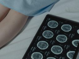 Hospitales Puerta de Hierro y la organización REVIVE Centro impulsan una campaña para concientizar y atender los infartos cerebrales. Unsplash.