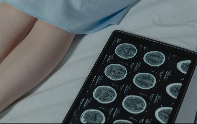 Hospitales Puerta de Hierro y la organización REVIVE Centro impulsan una campaña para concientizar y atender los infartos cerebrales. Unsplash.