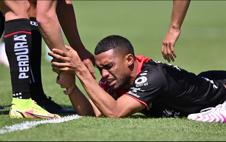 Mauro sufre una lesión de ligamento cruzado anterior. IMAGO7.