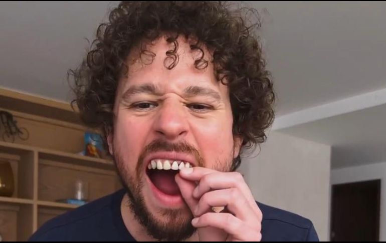 Esto pasó con los dientes de Luisito Comunica. CAPTURA