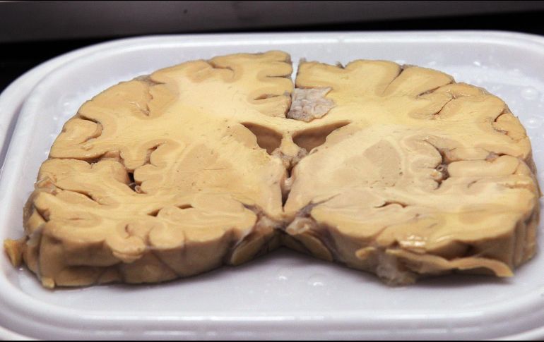 Este estudio revela la relación de los circuitos neuronales con la toma de decisiones. NOTIMEX/ARCHIVO
