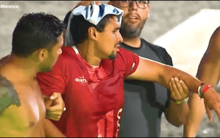 Pato Araujo sufrió un impactante golpe al colisionar con una barra de acero. /