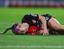 Las rojinegras comenzaron con el pie izquierdo este Clausura 2024. IMAGO7.