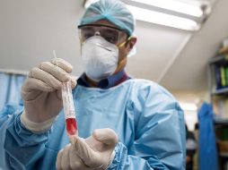 Los afroamericanos experimentaron alrededor del 30 % de los casos de sífilis congénita en 2022. NOTIMEX/ K. Melo