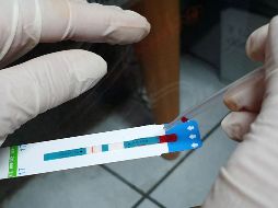 Al cierre de 2022, aproximadamente 370 mil personas vivían con VIH en México, y solo tres de cada 10 aún no conoce su estado serológico. EL INFORMADOR / ARCHIVO