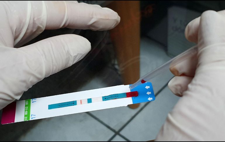 Al cierre de 2022, aproximadamente 370 mil personas vivían con VIH en México, y solo tres de cada 10 aún no conoce su estado serológico. EL INFORMADOR / ARCHIVO