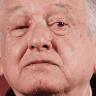 ¿Qué tiene López Obrador en el ojo, que mostró hoy en la "Mañanera"?