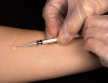 A nivel nacional, la enfermedad es monitoreada mediante el Sistema de Vigilancia Epidemiológica de las Enfermedades Febriles Exantemáticas. ESPECIAL