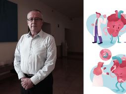 Estas afectaciones cardiacas se presentan de manera distinta en cada paciente. SUN / RDB / ARCHIVO