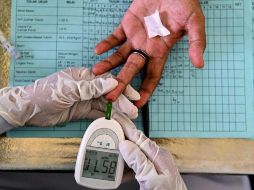 Si la hiperglucemia no se trata, puede favorecer la acumulación de ácidos tóxicos (cetonas) en la sangre y en la orina. AFP / ARCHIVO
