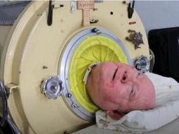 Cuando era niño, Alexander, quien vivía en Texas, contrajo poliomielitis en 1952, dejándolo paralizado del cuello para abajo. ESPECIAL