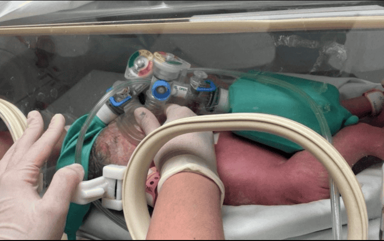 Ambas fueron valoradas por especialistas del Hospital Metropolitano y trasladadas al área de cuidados intensivos del nosocomio. ESPECIAL/ Comunicación Central del Gobierno de NL