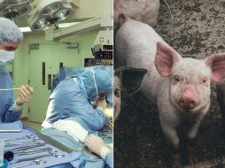 Los científicos desactivaron retrovirus endógenos del cerdo para minimizar posibles infecciones. UNSPLASH / D.  Renco /  National Cancer Institute / ARCHIVO