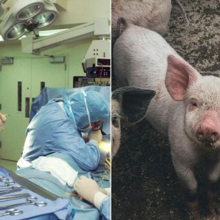 Trasplantan el riñón de un cerdo modificado genéticamente a un paciente en EU