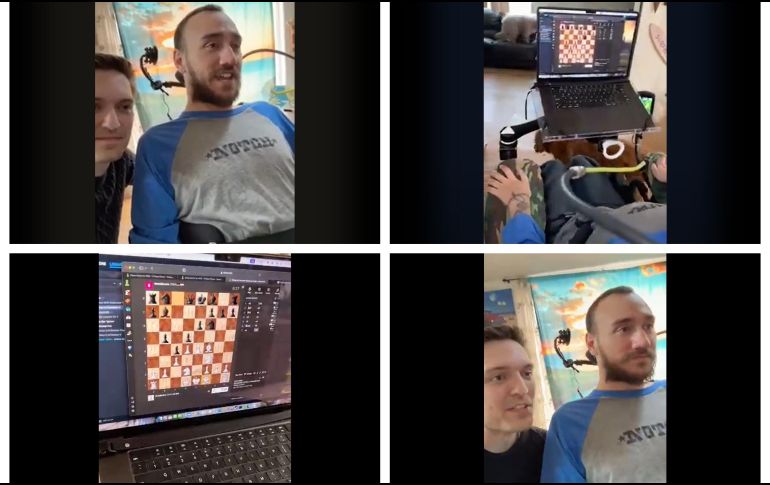 Primer paciente humano hace uso de implante cerebral para interactuar con computadora. ESPECIAL/@neuralink