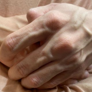 ¿Por qué razón la ansiedad causa problemas gastrointestinales?