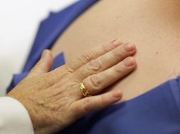 Es importante dar a conocer que esta enfermedad de la piel no es contagiosa. AFP / ARCHIVO