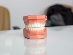 La elección de ciertos alimentos puede contribuir significativamente a la salud de nuestros dientes y encías. ESPECIAL/ Foto de Enis Yavuz en Unsplash
