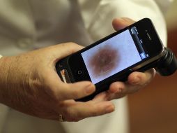 Los lunares se clasifican de acuerdo a su aspecto, con las características observadas al microscopio y su origen. AFP / ARCHIVO