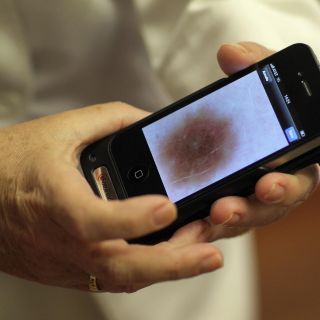 ¿Cuándo un lunar se vuelve peligroso?