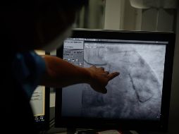 Los adolescentes y jóvenes entre 10 y 25 años de edad son los más propensos a presentar apendicitis. EL INFORMADOR / ARCHIVO