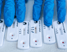 El informe semanal de la Covid-19 menciona la confirmación de casos mediante la prueba de RT-PCR. EL INFORMADOR / ARCHIVO