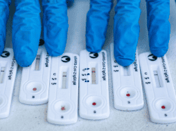 El informe semanal de la Covid-19 menciona la confirmación de casos mediante la prueba de RT-PCR. EL INFORMADOR / ARCHIVO